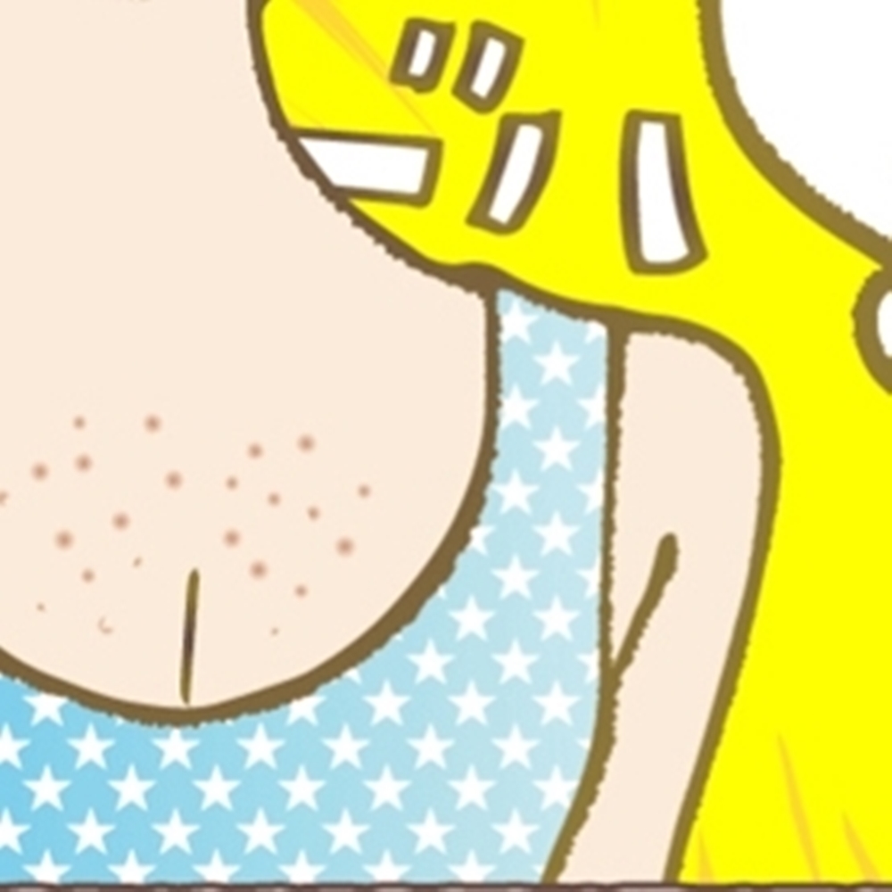 모공 각화증 닭살 피부 로션 - 상세 이미지 3
