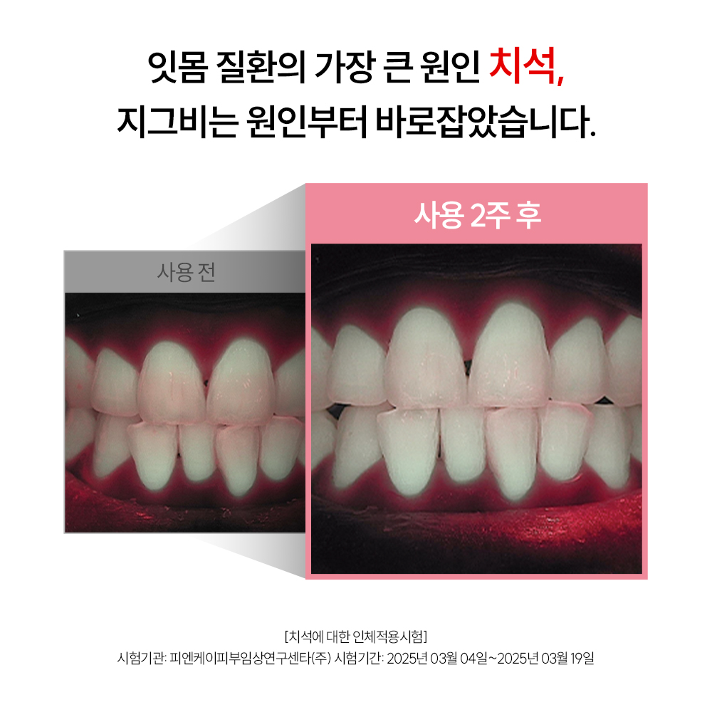 잇몸케어 치약 추천 고불소 치약 허니민트향 지그비 리뷰