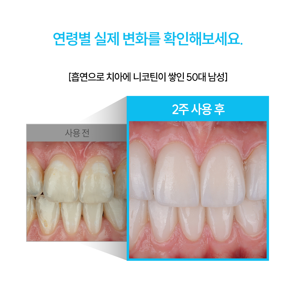 지그비미백케어 미백치약 입냄새해결 치약후기 구강관리