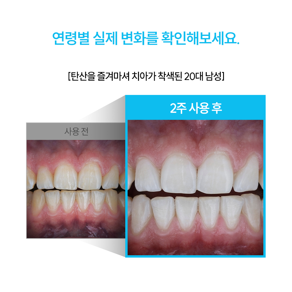 지그비미백케어 미백치약 입냄새해결 치약후기 구강관리