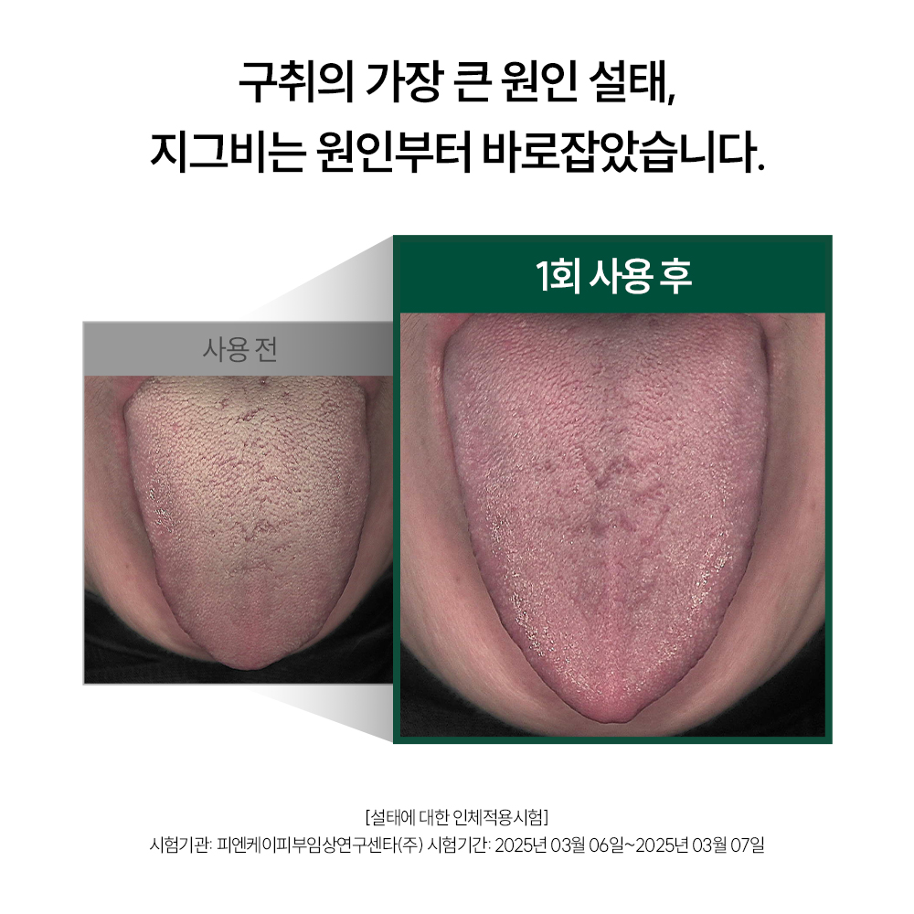 입냄새 제거 치약 추천 지그비 고불소 치약 아쿠아민트 후기