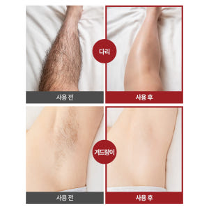 먼프리 셀프 김영대 제모 크림 팔 다리 겨드랑이 왁싱 200ml, 2개 솔직 후기 | 피부 타입별 분석 - 상품 이미지 2