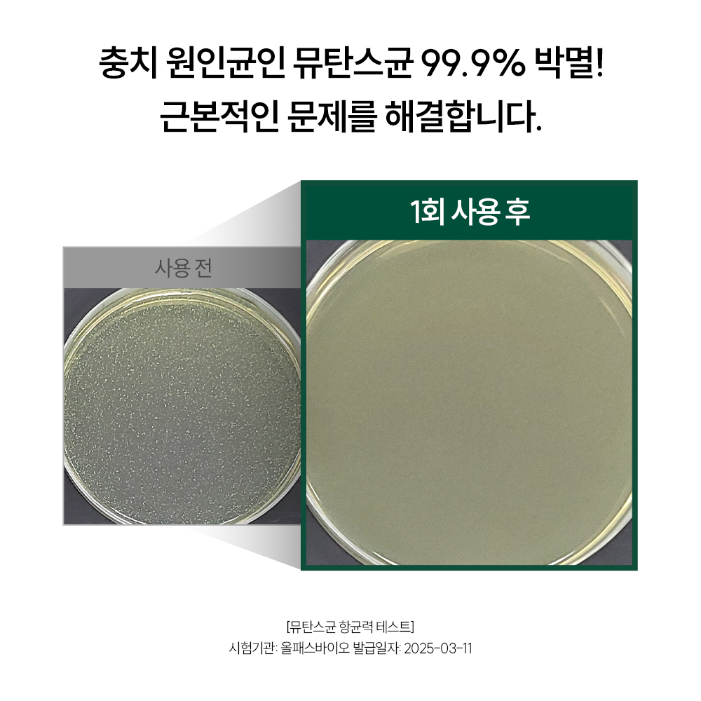 입냄새 제거 치약 추천 지그비 고불소 치약 아쿠아민트 후기