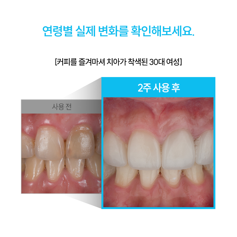지그비미백케어 미백치약 입냄새해결 치약후기 구강관리