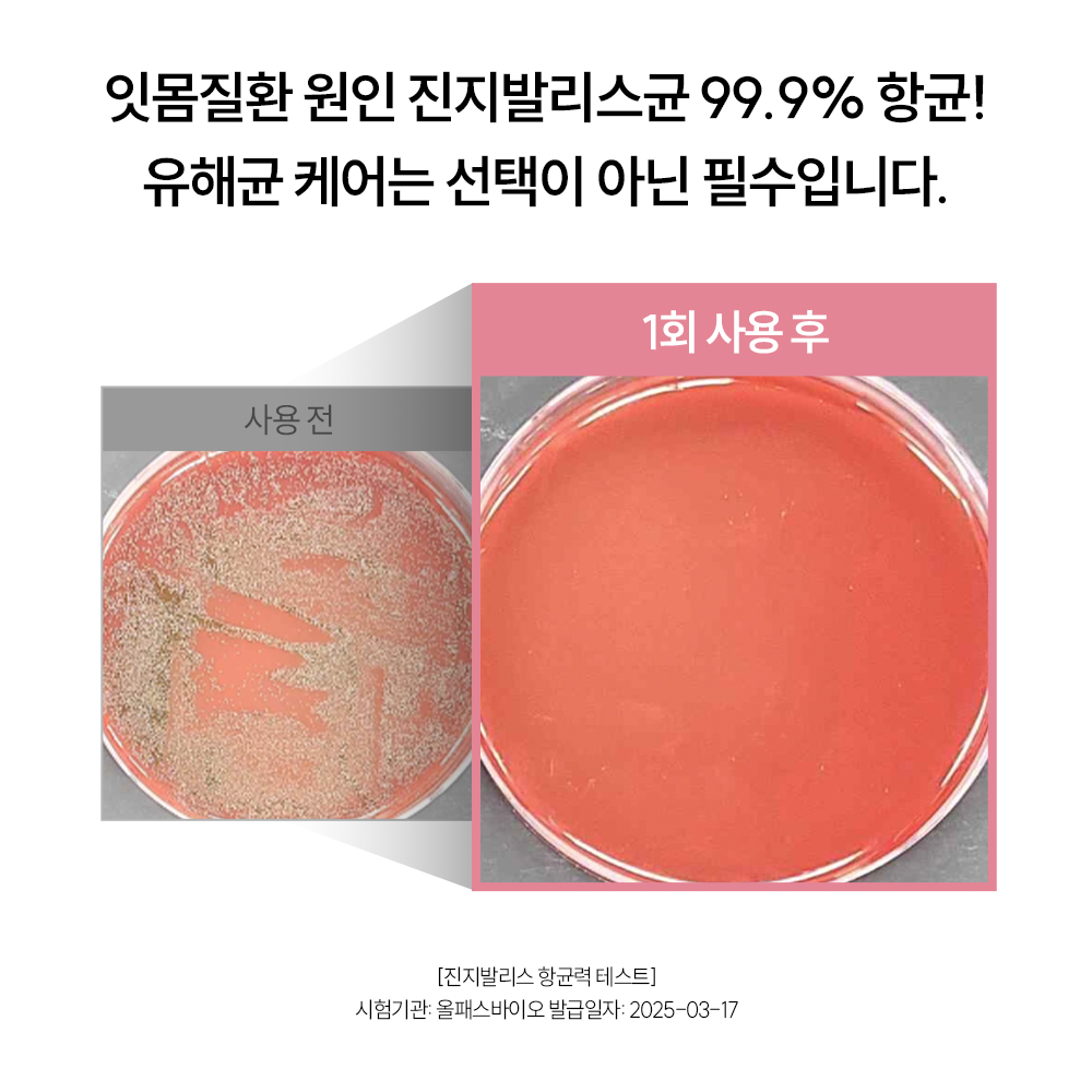 잇몸케어 치약 추천 고불소 치약 허니민트향 지그비 리뷰