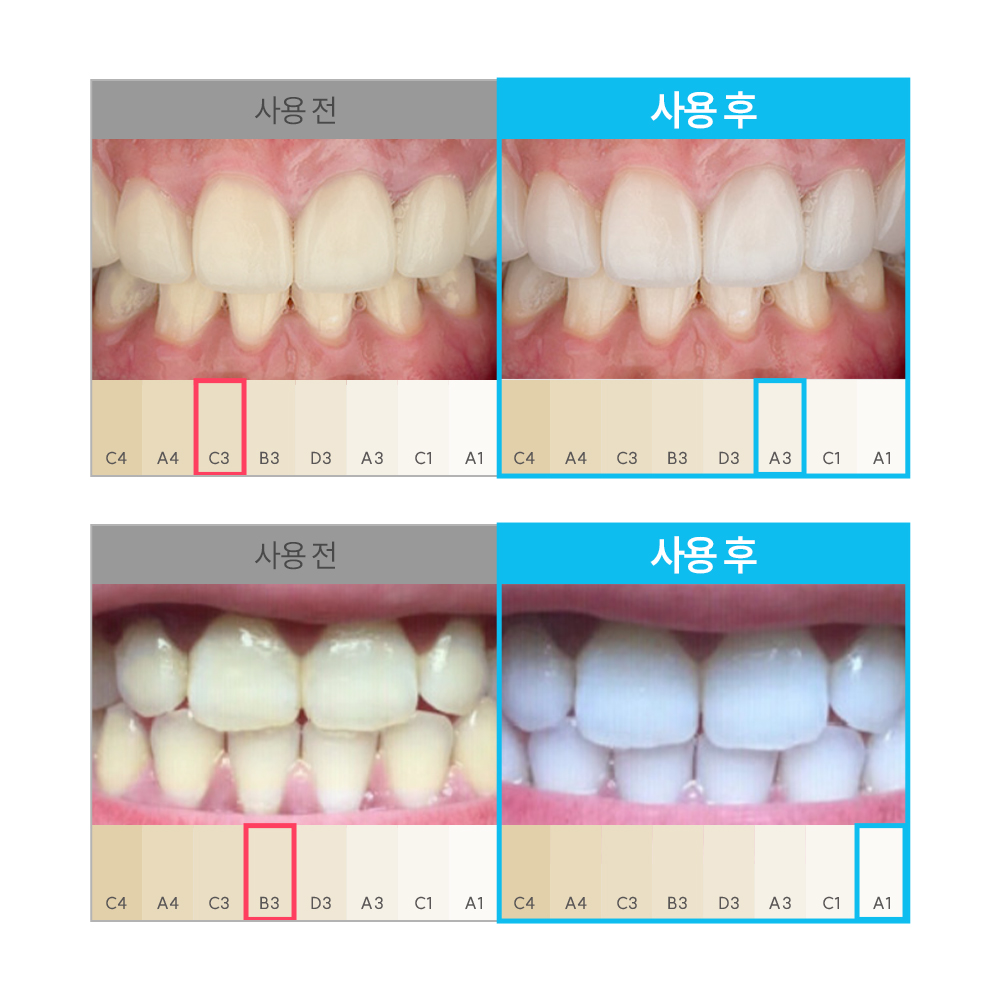 지그비미백케어 미백치약 입냄새해결 치약후기 구강관리