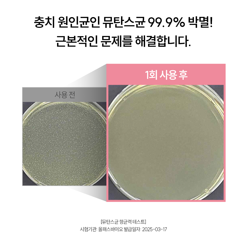 잇몸케어 치약 추천 고불소 치약 허니민트향 지그비 리뷰
