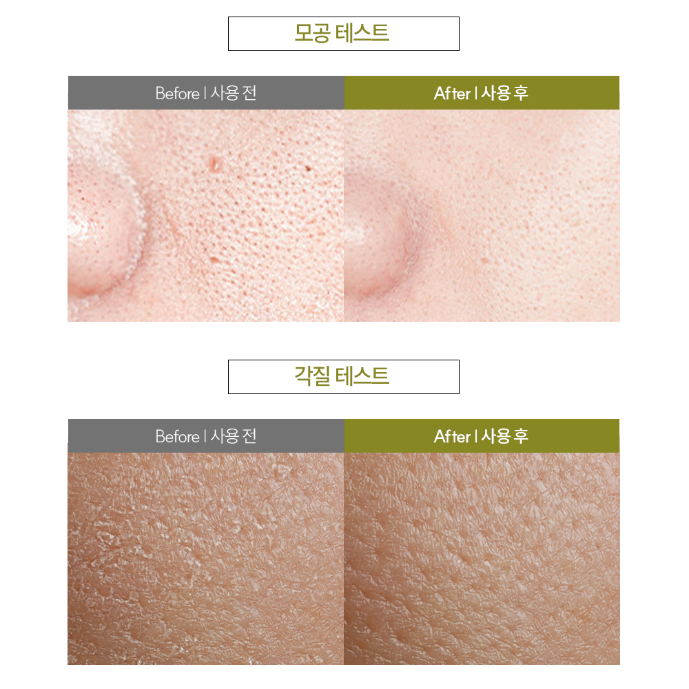 먼프리 어성초 모공 흡착 김영대 클렌징 세수 세안 비누 125g, 4개 - 상세 이미지 4