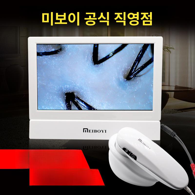 두피 모낭 검사기 고화질 일체형 헤어샵 테스트기 스크린 포함 단일 렌즈 200배 두피 모낭 검사 - 상세 이미지 2