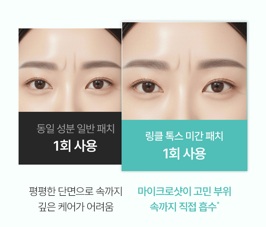CHARDE Wrinkle-Tox Frown Line Patch - details 8