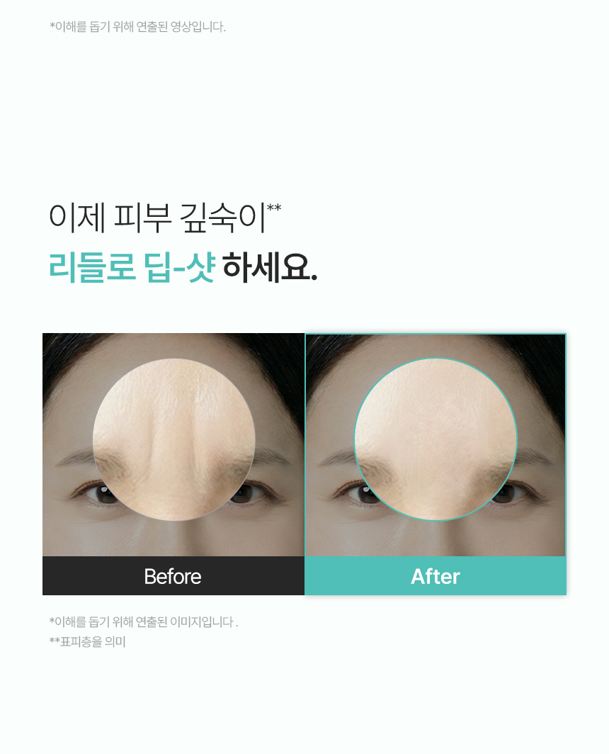 CHARDE Wrinkle-Tox Frown Line Patch - details 24