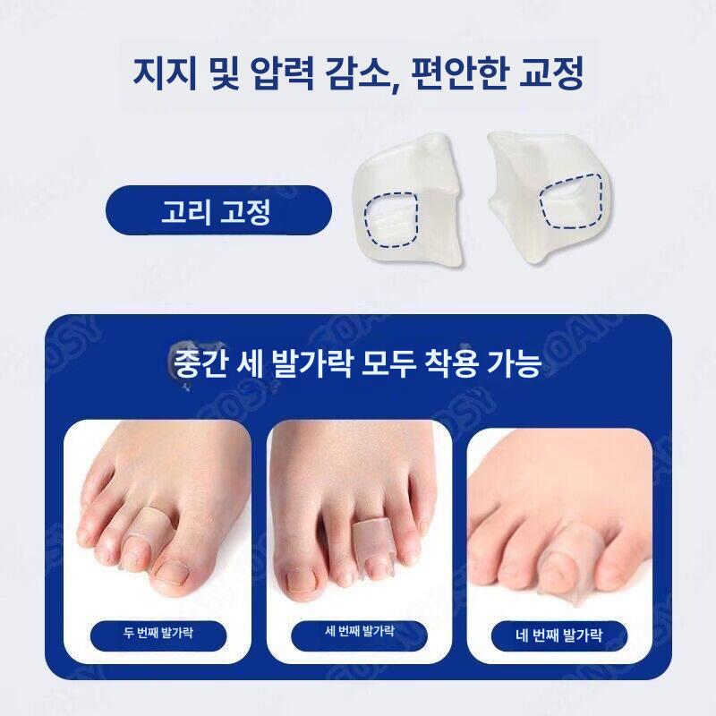 발가락 분리기 캡 교정기 발까락 끼우개 벌리개 링 캡형 1개입 꼬리발가락교정기 - 상세 이미지 2