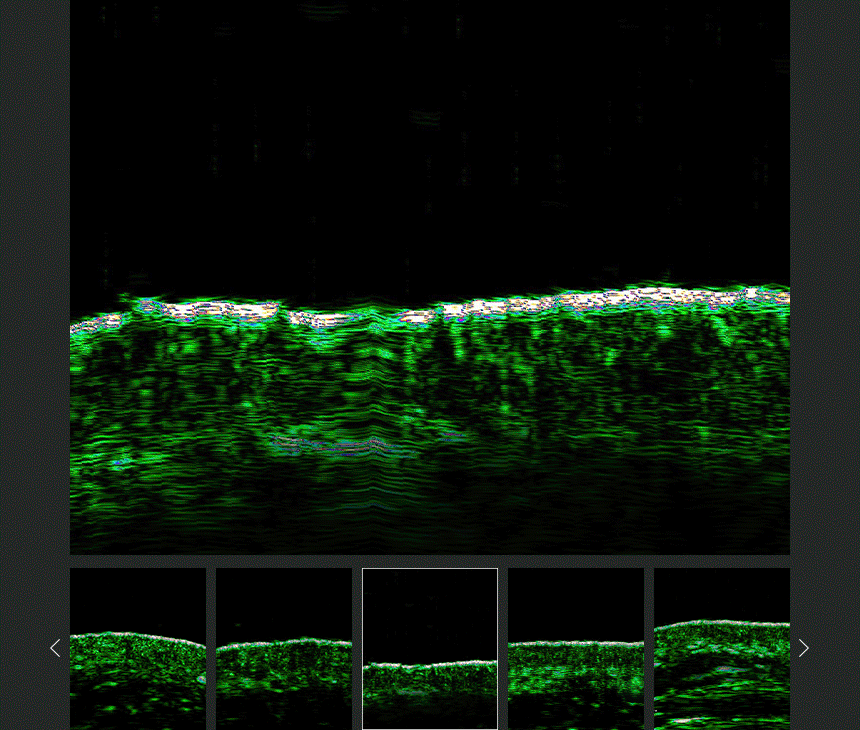 CHARDE Wrinkle-Tox Frown Line Patch - details 36