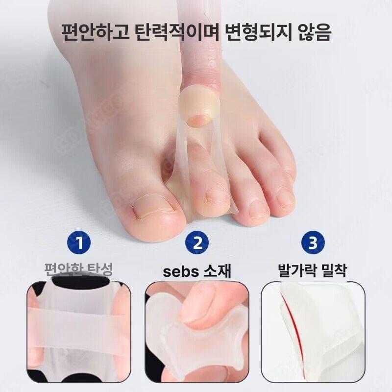 발가락 분리기 캡 교정기 발까락 끼우개 벌리개 링 캡형 1개입 꼬리발가락교정기 - 상세 이미지 3