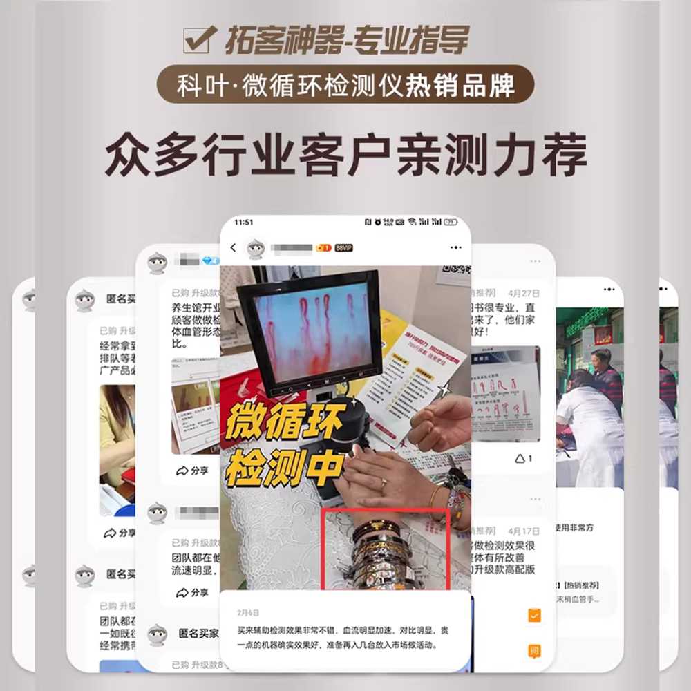 실체현미경 LCD 조명 편광 고배율 전자 카메라 혈관 7인치 - 상세 이미지 4