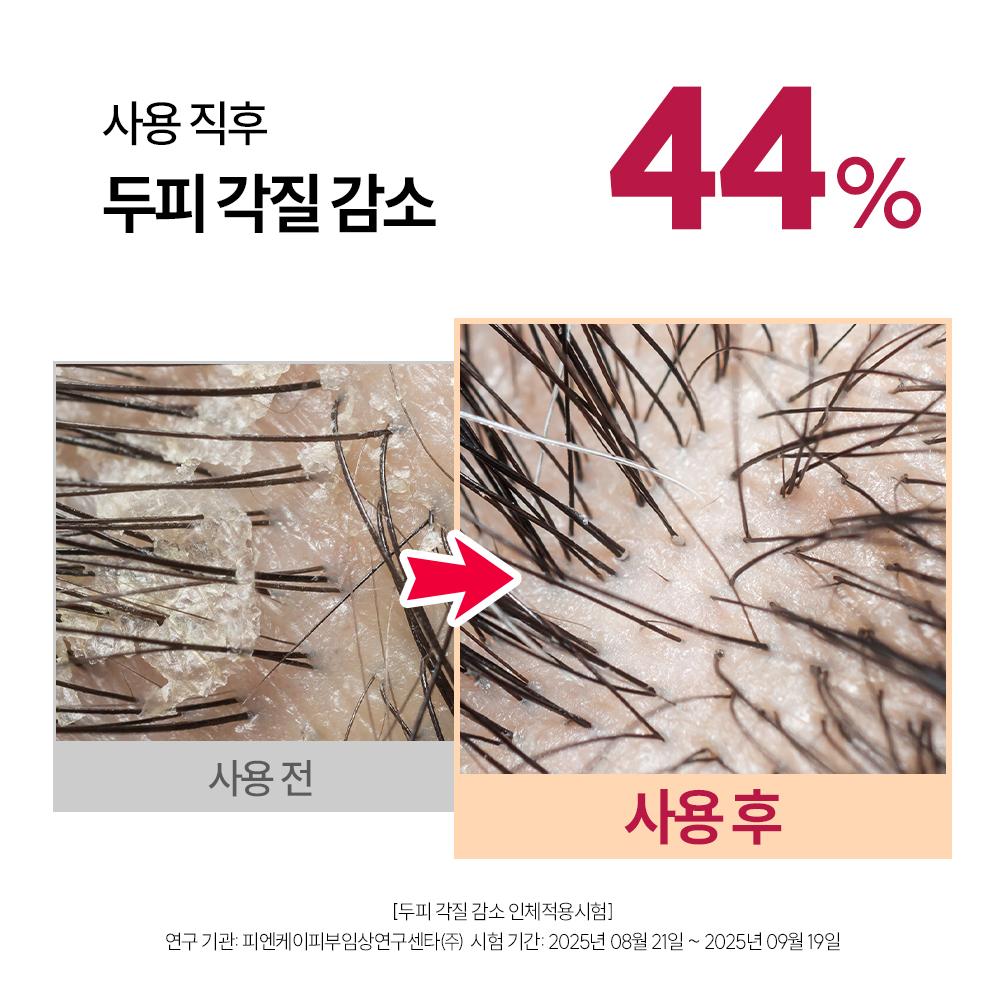 먼프리 엑소좀 줄기세포 탈모완화 김영대 샴푸 두피 손상모발 개선 다즐링티, 519ml, 2개 이미지 7