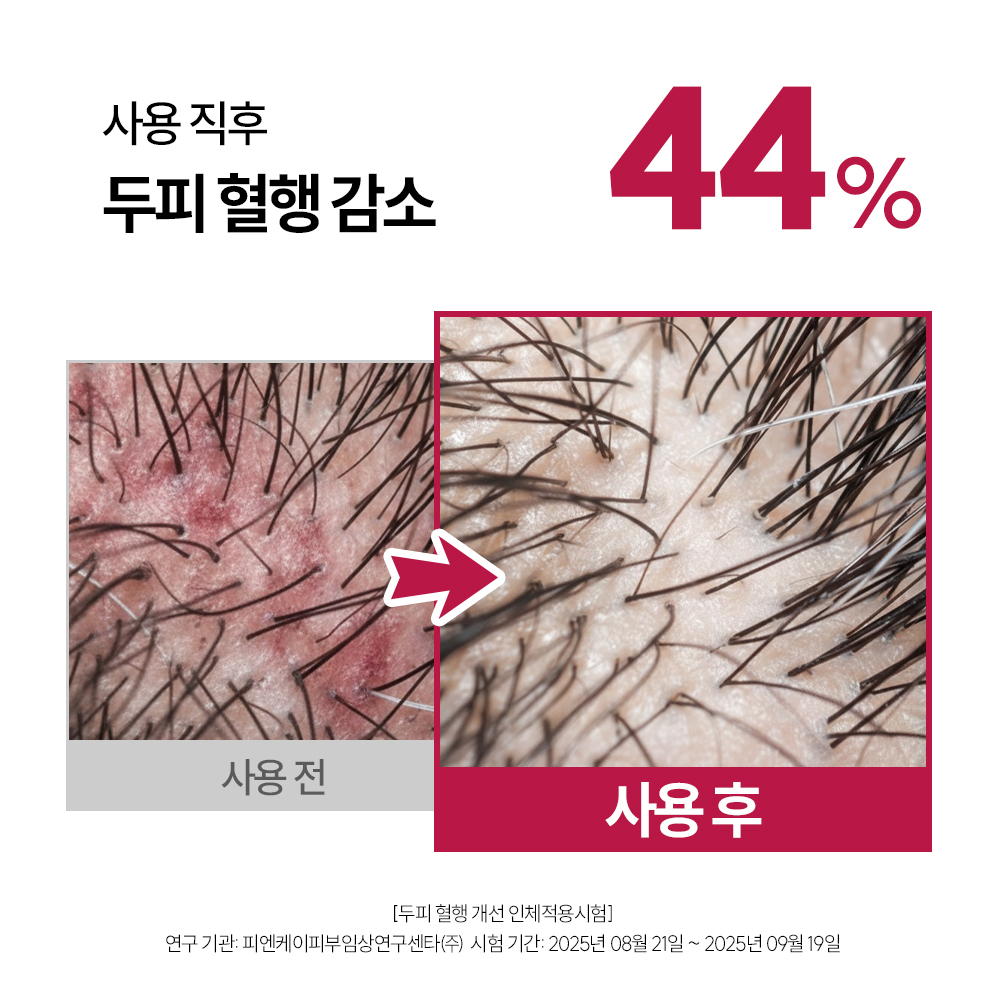 먼프리 엑소좀 줄기세포 탈모완화 김영대 샴푸 두피 손상모발 개선 다즐링티, 519ml, 2개 이미지 8