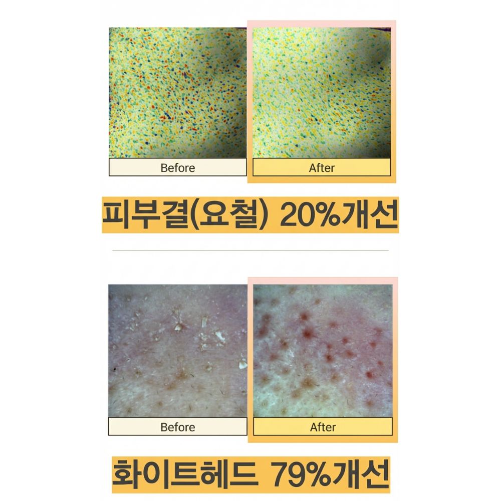 율무담 스피큘 율무 팩 나이아신아마이드 피지 화이트헤드 각질 개선 저자극 - 상세 이미지 2