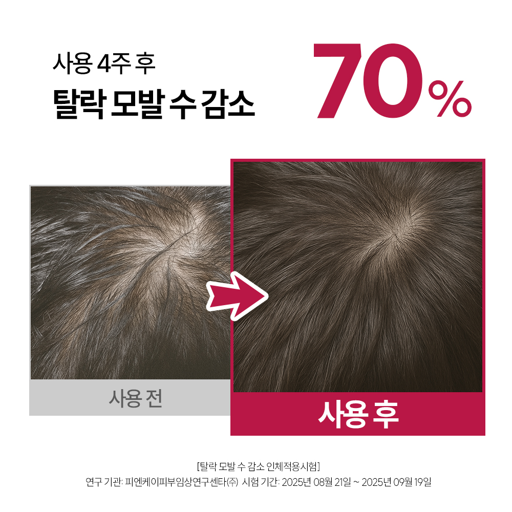 먼프리 엑소좀 줄기세포 탈모완화 김영대 샴푸 두피 손상모발 개선 다즐링티, 519ml, 2개 - 상세 이미지 5