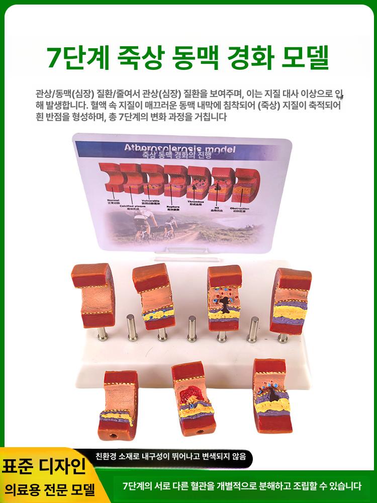 의대 교육용 혈관모형 해부학 보건 동맥 경화 혈전 단일 항목 - 상세 이미지 4