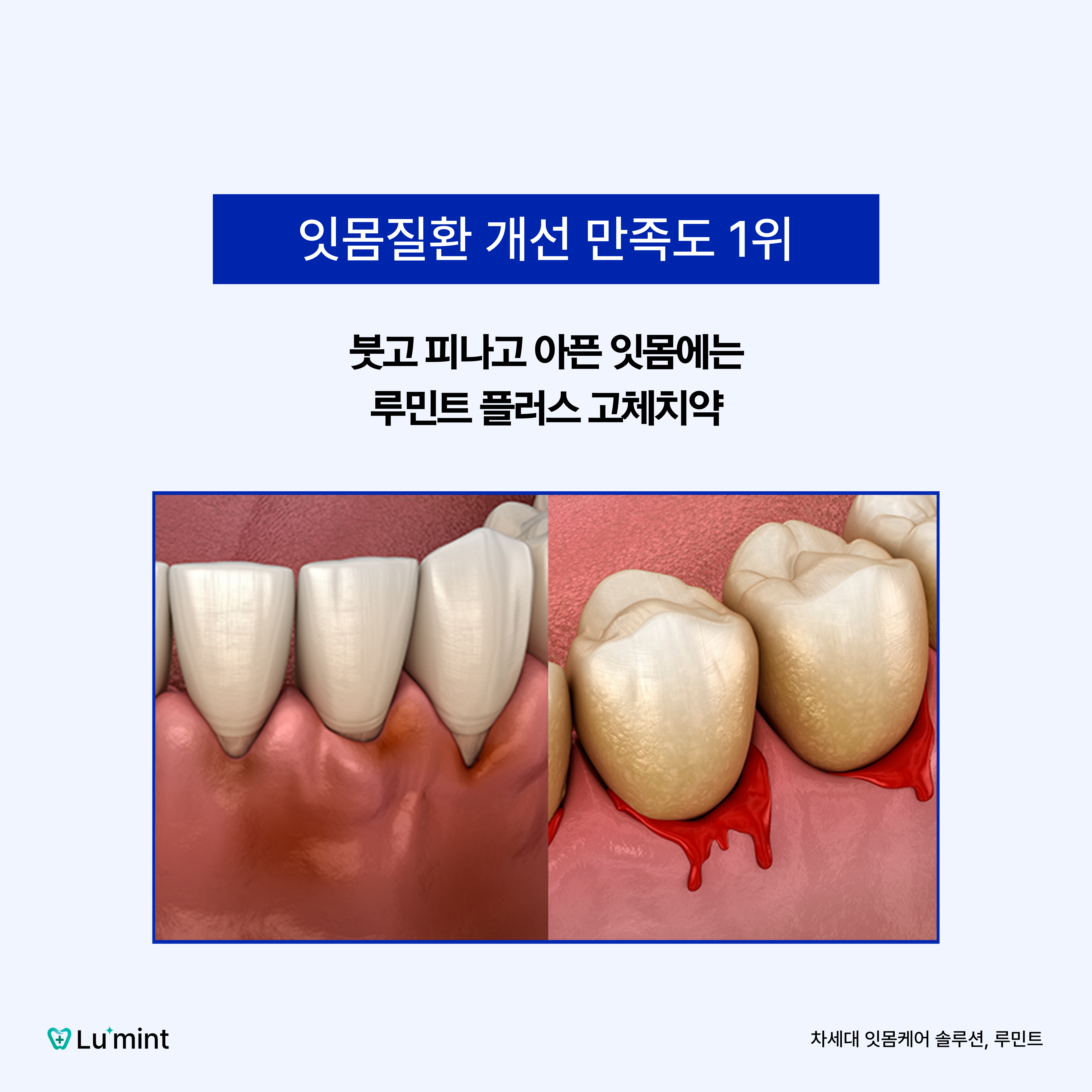 루민트 플러스 고체치약 300정 대용량 (10박스 + 칫솔10개 + 쇼핑백) - 상세 이미지 4