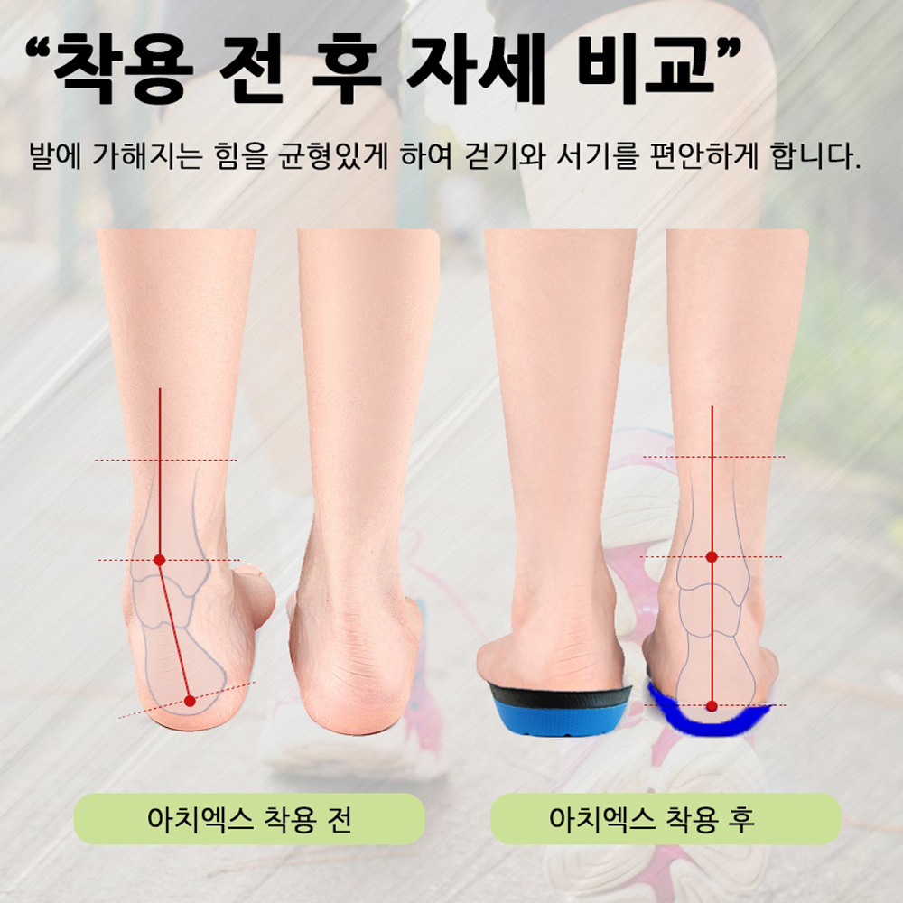아치엑스 아치 깔창 기능성 평발 발아치 쿠션 인솔 운동화 오다리 군대 군화 신발 이미지 4