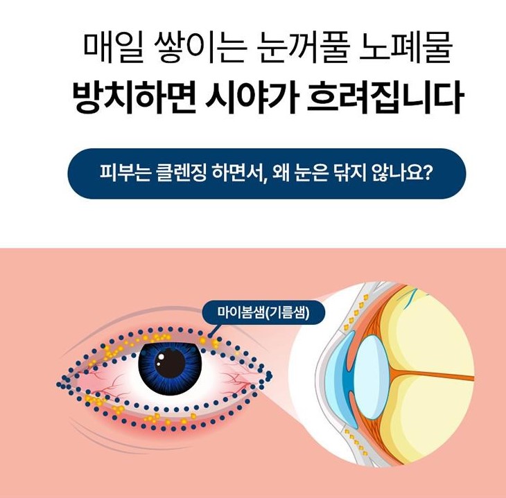 약국입점 메디케이 클린아이솔루션 눈꺼풀세정제 대용량 150ml+의약외품 거즈100매 마이봄샘 아이클리너 눈기름샘청소 이미지 4