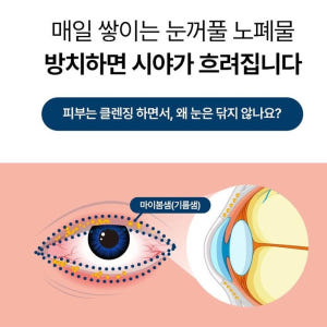 약국입점 메디케이 클린아이솔루션 눈꺼풀세정제 대용량 150ml+의약외품 ... 솔직 후기 | 피부 타입별 분석 - 상품 이미지 4