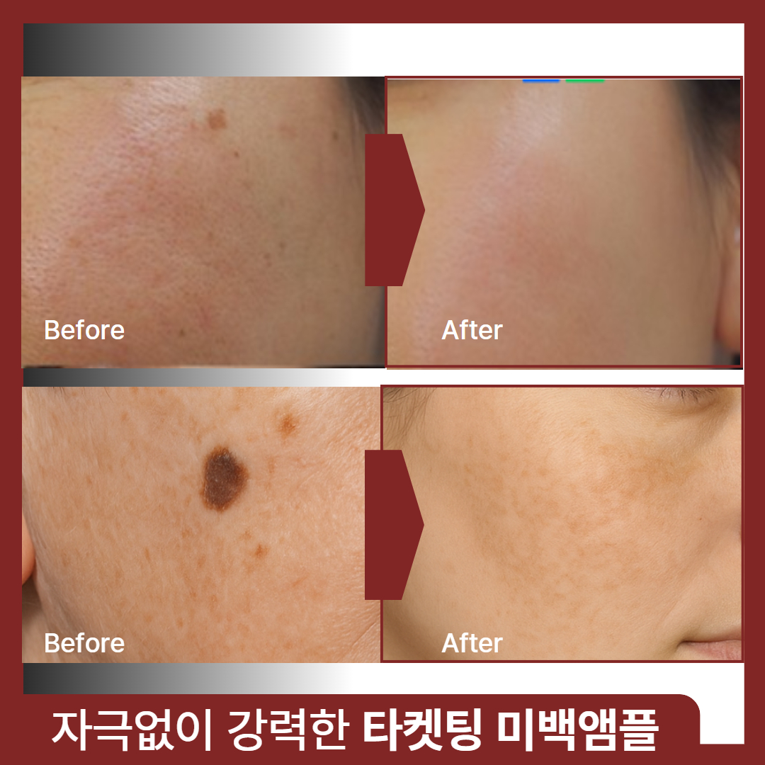 멜라피엘 흔적 잡티 기미 흑자 색소침착케어 주름 미백앰플, 50ml - 상세 이미지 3