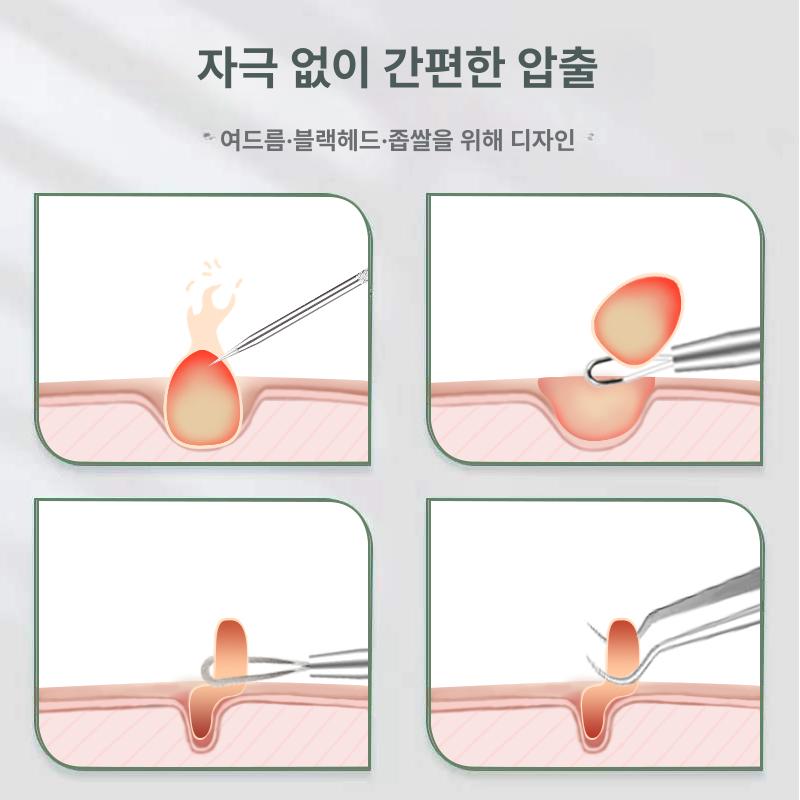 여드름 블랙헤드 압출기 핀셋 바늘 세트 얼굴 짜는 도구 셀프케어 1피부 주름 바늘 - 상세 이미지 3