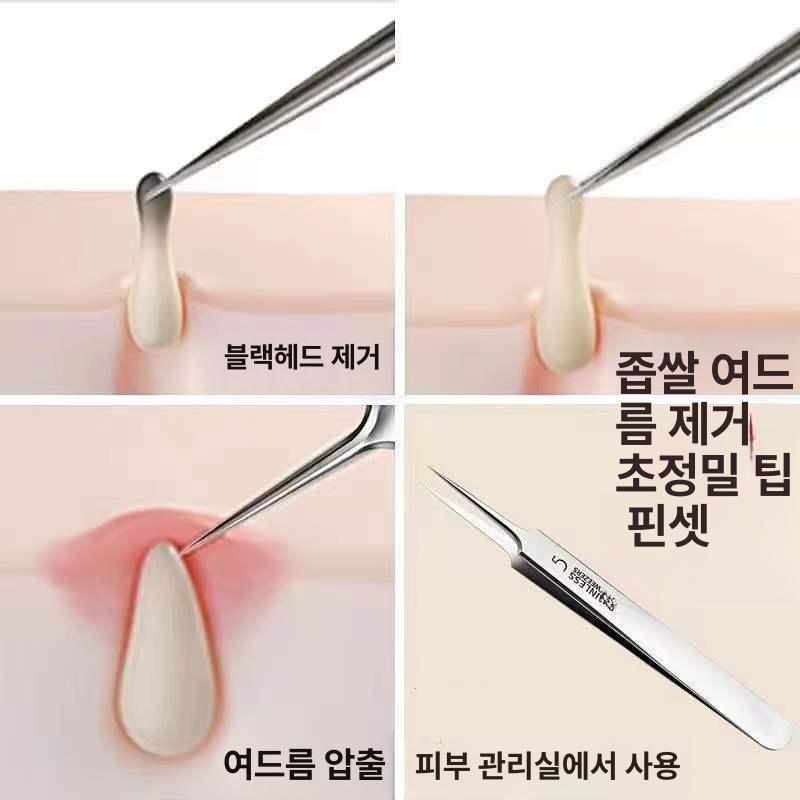 여드름 블랙헤드 압출기 핀셋 바늘 세트 얼굴 짜는 도구 셀프케어 1피부 주름 바늘 - 상세 이미지 2