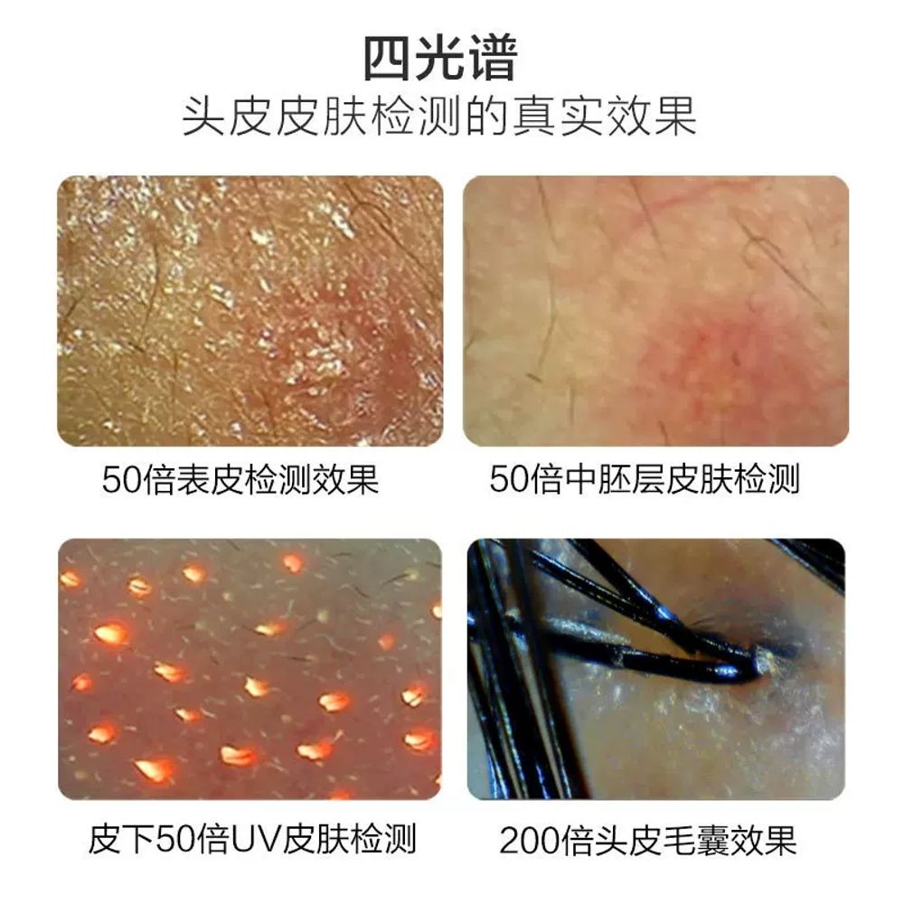 진단기 인치모니터 카메 A. 검출기 모낭 HD 측정기 얼굴 전담분석 4스펙트럼 올인원 머신 - 상세 이미지 3