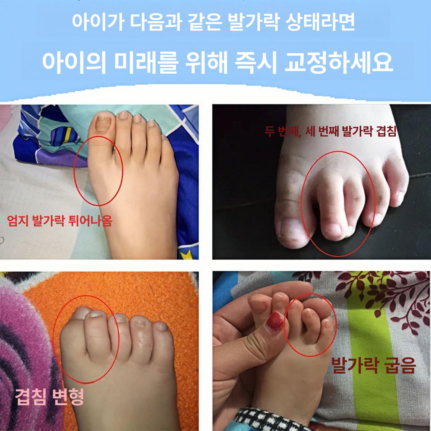 발가락 교정기 엄지 검지 휜발 교정 중지 통증완화 약지 0-12개월 두 발가락 화이트 - 상세 이미지 5