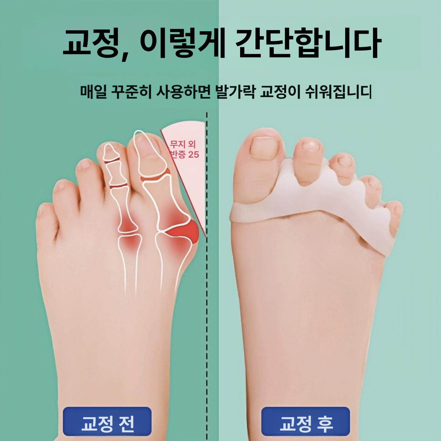 발가락 교정기 엄지 검지 휜발 교정 중지 통증완화 약지 0-12개월 두 발가락 화이트 - 상세 이미지 3