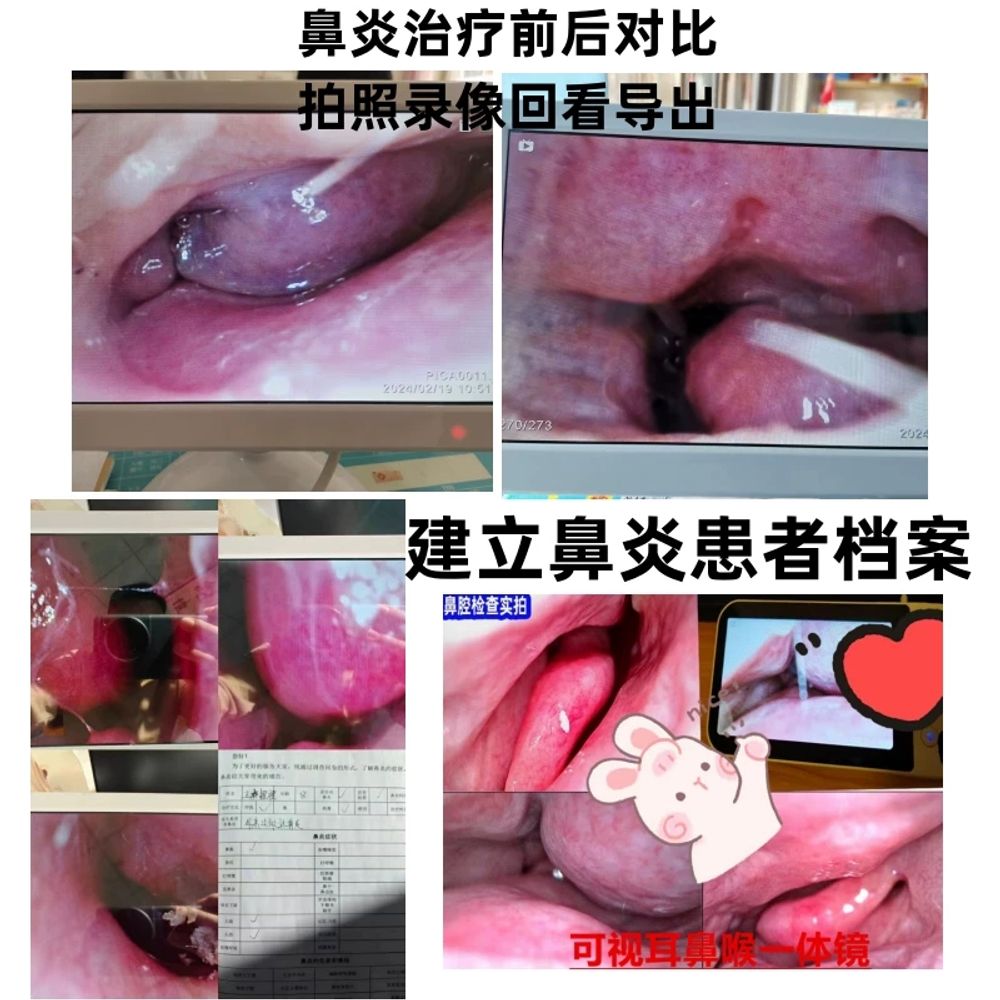 스크린 열화상카메라 플리어 가능 플리어 프로급 안드 - 상세 이미지 5
