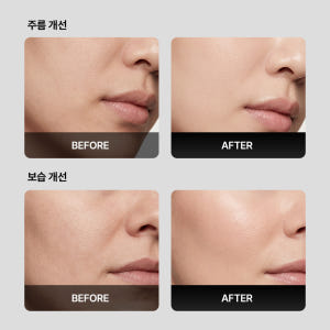 [밀리밀리 공식] 1개｜500달톤 프로틴 앰플 공식 미백/주름개선/탄력 ... 솔직 후기 | 피부 타입별 분석 - 상품 이미지 3
