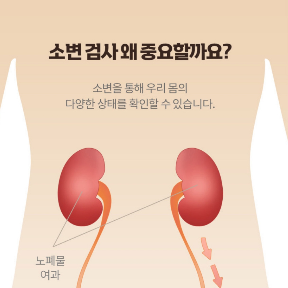소변검사스틱 단백뇨스틱 소변검사키트 단백뇨검사지 - 상세 이미지 5