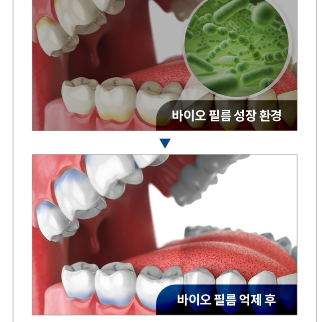 덴마크 구강유산균 특허 LGG 분말 입냄새제거 입속 치아 잇몸 구취 자일리톨 덴탈 이미지 3