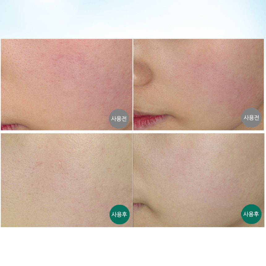 메르필 수면팩 붉은기 홍조크림 흔적 자국 진정 오버나이트크림 레드스킨 100ml, 2개