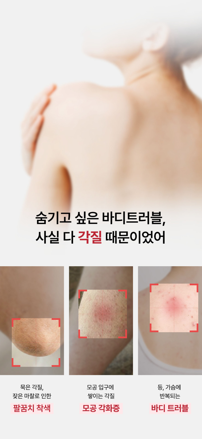 29.11_13_바디트러블_문제제기.jpg (860×1865)