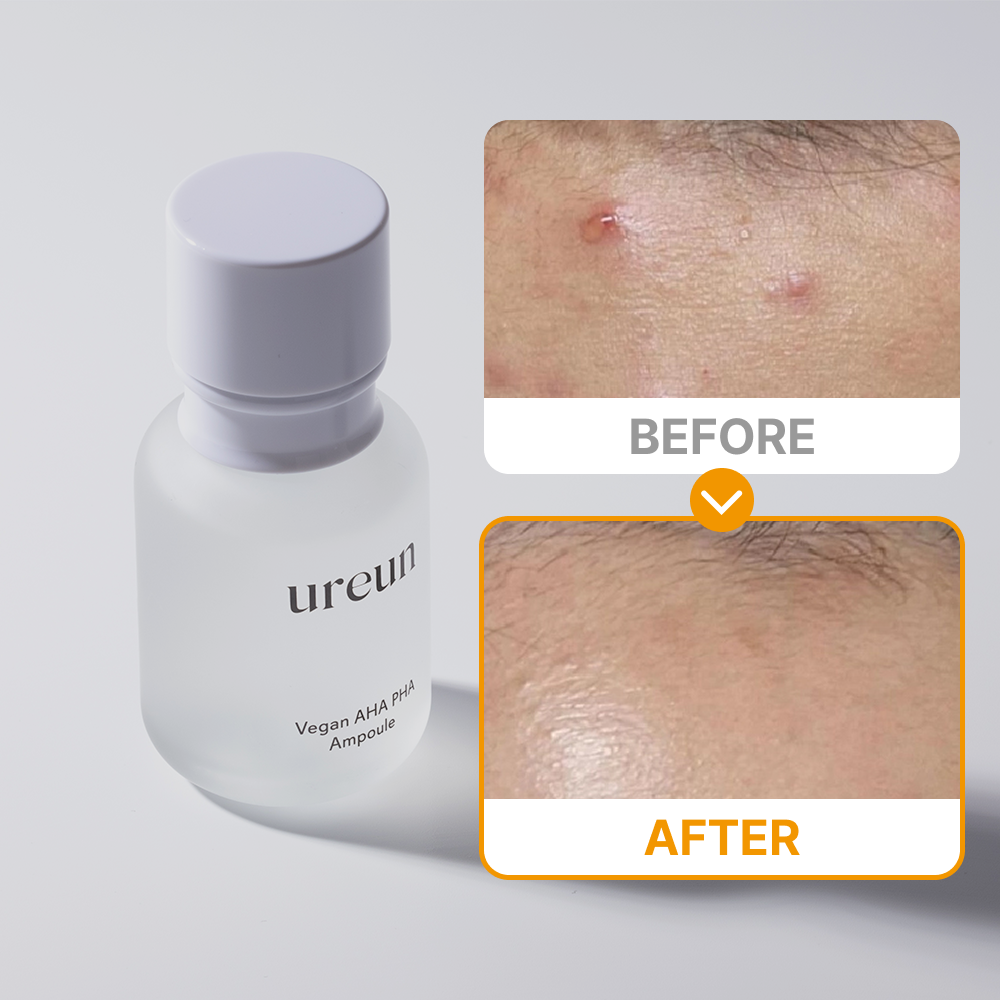 유아른 비건 아하파하 앰플 55ml 이미지 3