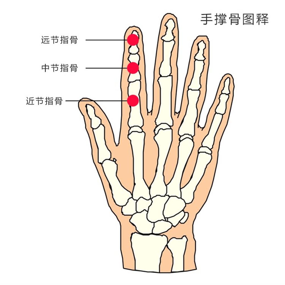 손가락펴는기계 손가락 손가락교정 굽힘 A. 교정기 개, A. 하나의 사이즈로 모든 용도에 - 상세 이미지 4