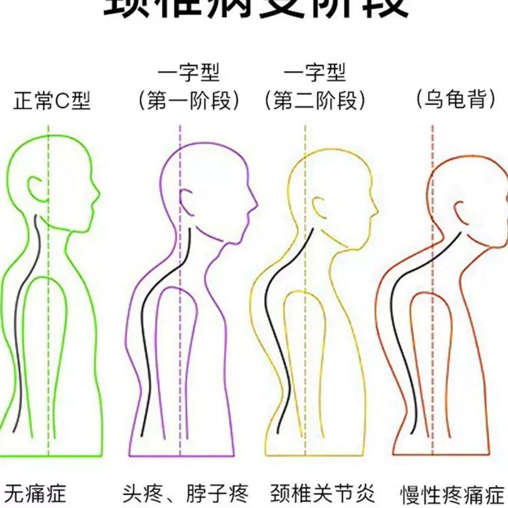 목견 견 경추 기구 목디스 A. 장착형걸 수 있는 곳을 찾아야 함 표준 캔버스 견인 스트랩 - 상세 이미지 3