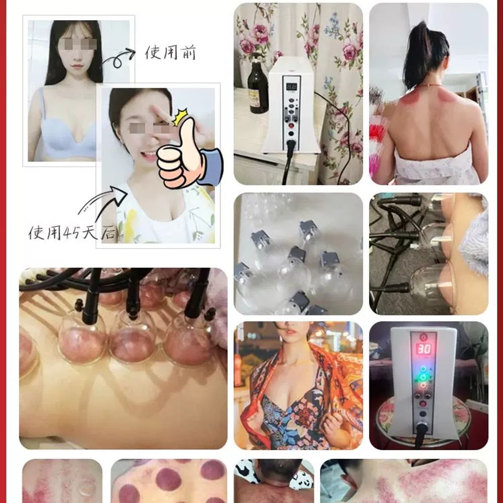 가슴마사지기계 부항 흡입장치 안마기 B. 스페셜 에디션 29컵 2컵 5가지 오일 동시 사용 - 상세 이미지 3