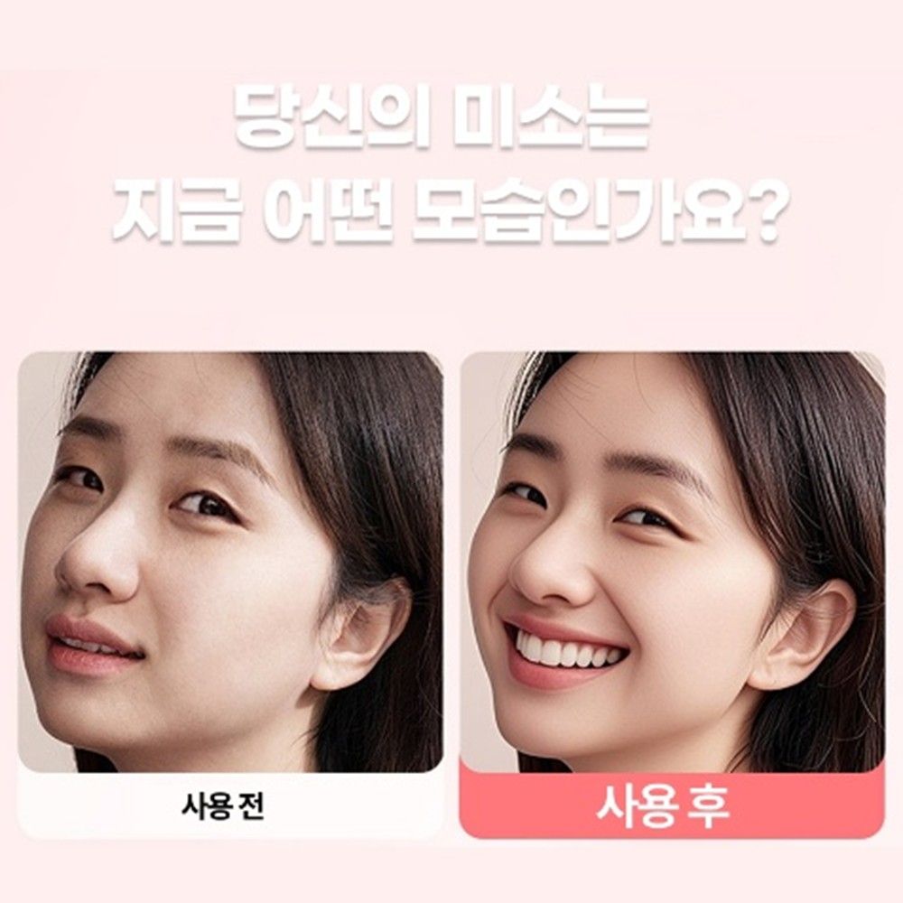 1+1 입꼬리 올리기 교정기 미소연습 웃는얼굴 만들기 일반형 이미지 3