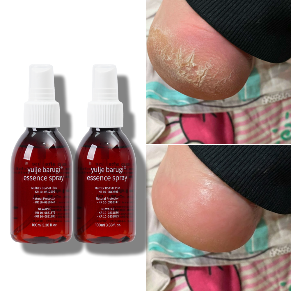 [EVENT] 율제 바루기 손 발톱 무좀 에센스 크림  풋 스프레이 2개월 SET 제품 이미지