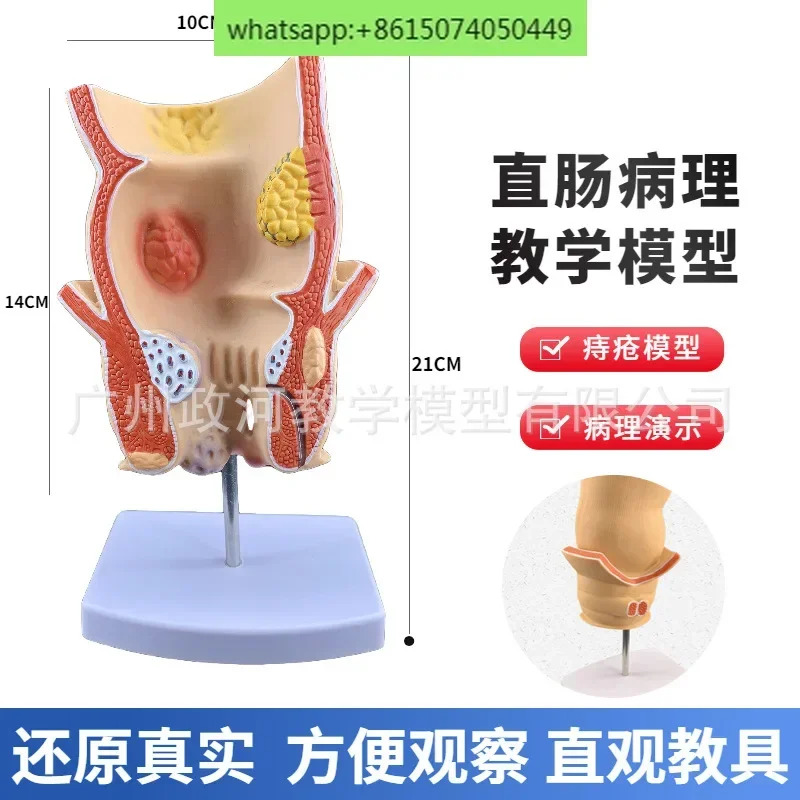 인대장 병리학 직장 표시 대장 해부 기관 구조 모델 12개시스템