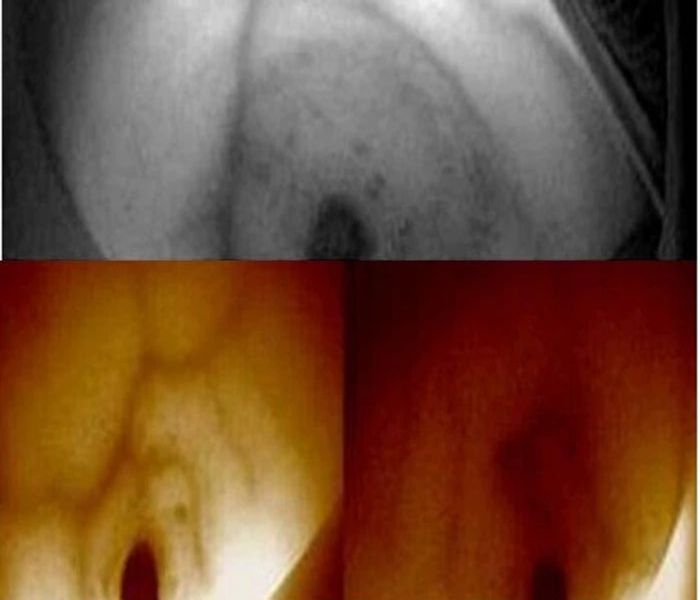 혈관탐지기 간호실습 정맥 스캐너 적외선 전원 휴대용 충전식 화이트 - 상세 이미지 5