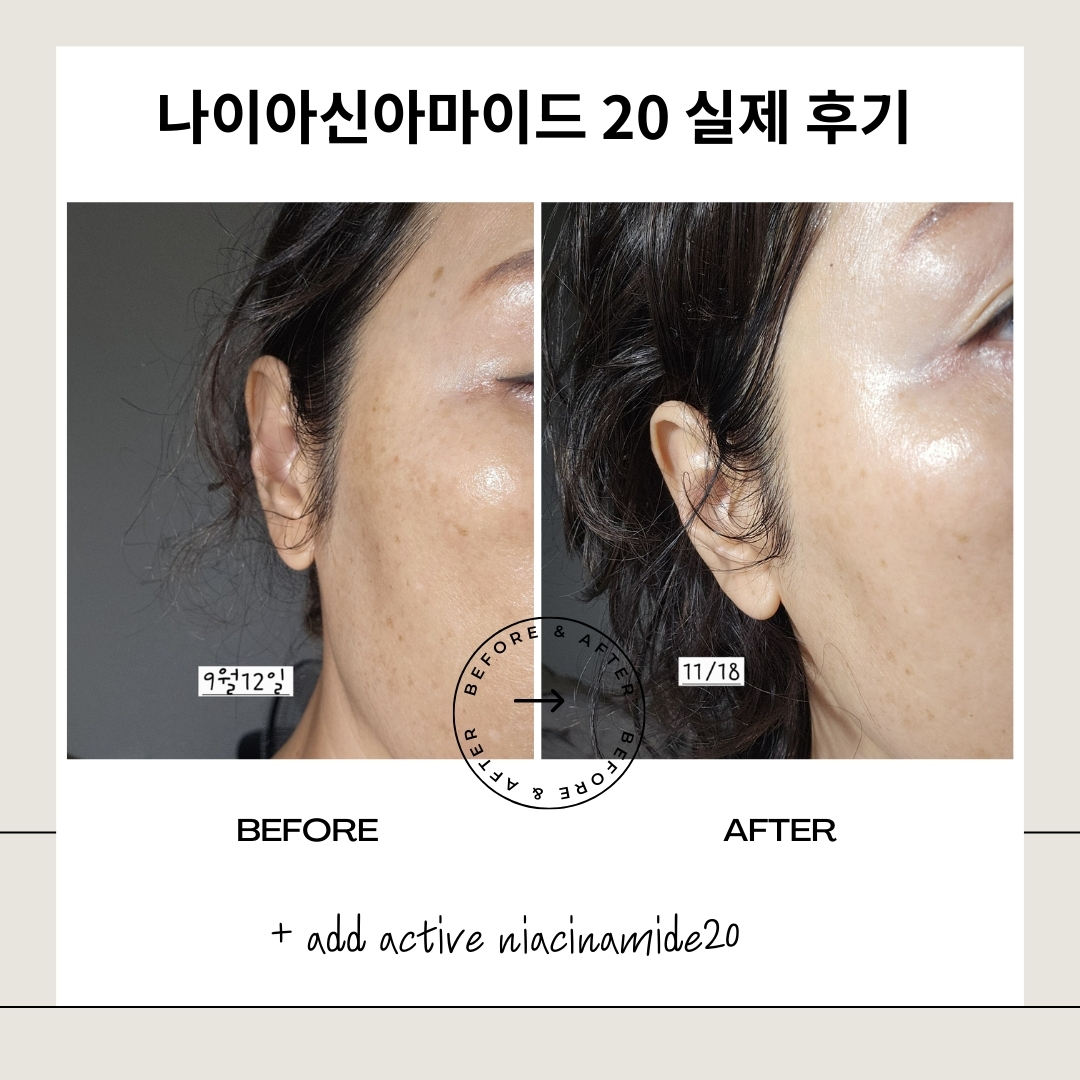 나이아신 아마이드 20% 앰플 니아신아마이드 고함량 세럼 에센스 NIACINAMIDE 이미지 7