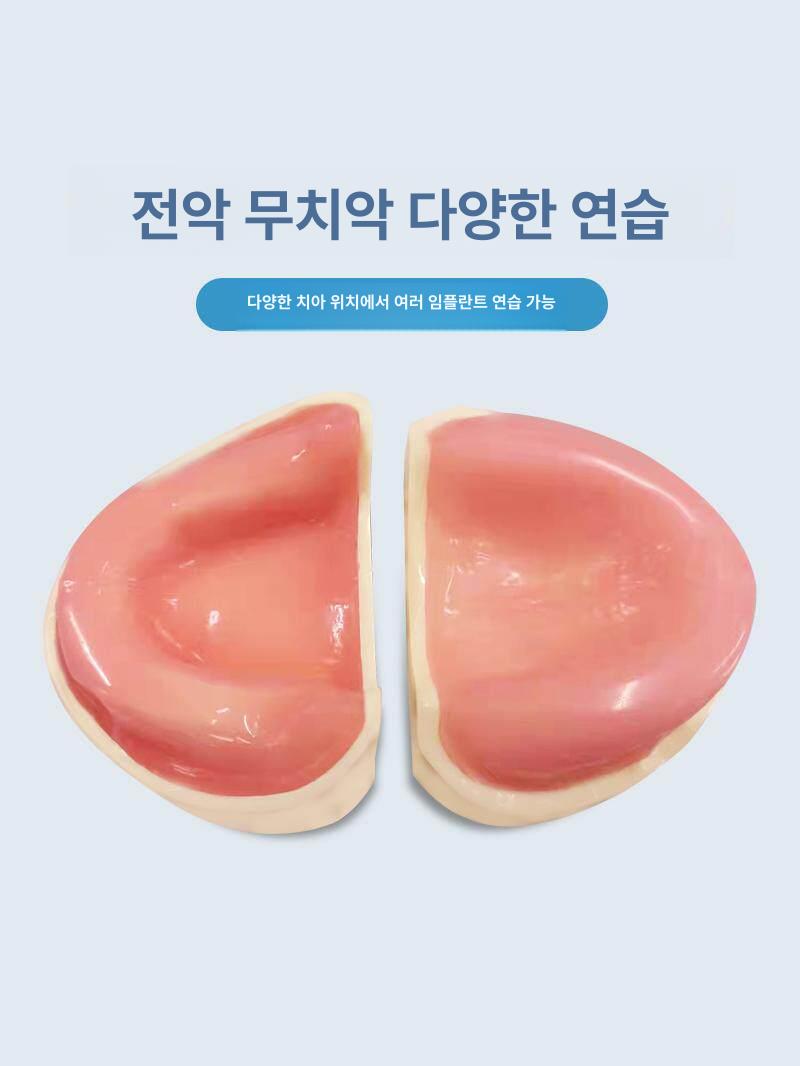 치아모형 구강구조 치과 의사 수지 무치악 임플란트 모델 무턱 수지 치아 모형 - 상세 이미지 3